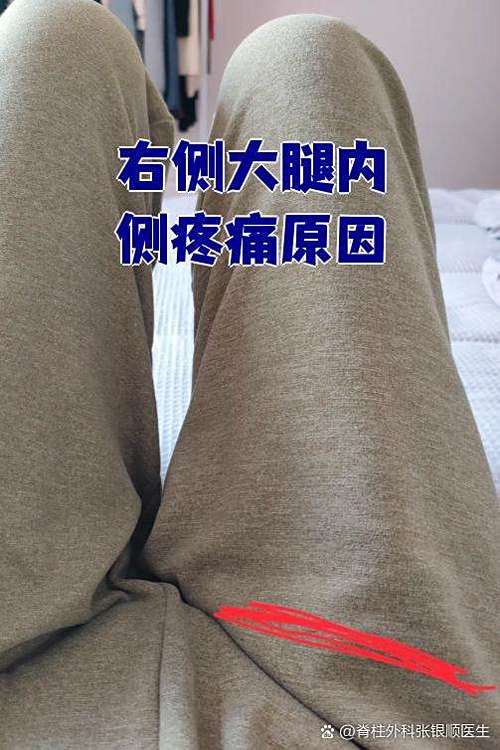 右大腿疼痛位置图缩略图