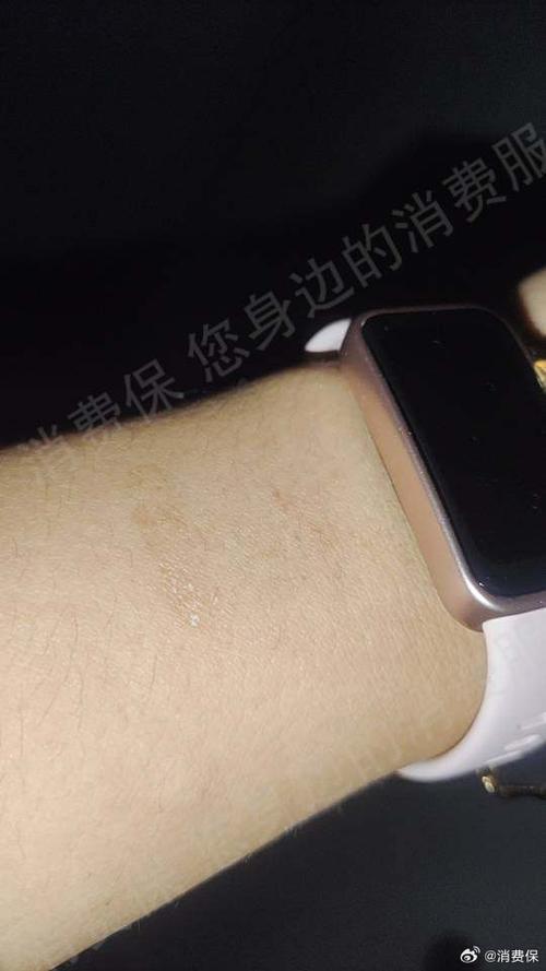 华为手环手腕有刺痛的感觉