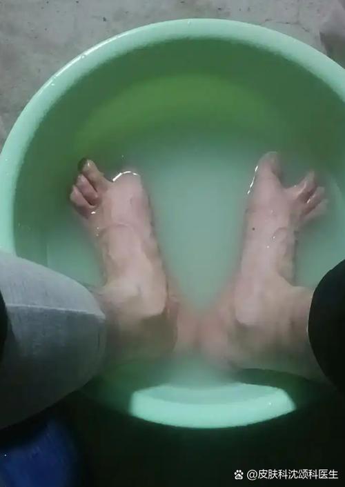 鞋子顶大母脚趾怎么办
