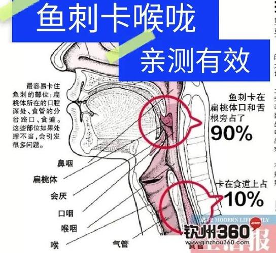 鱼刺卡喉教你一招鱼刺自己跑出来
