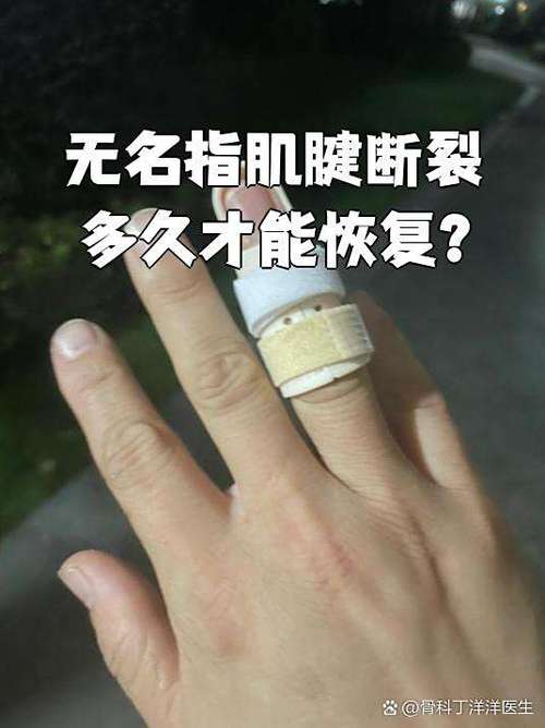 手指断了多长时间能恢复
