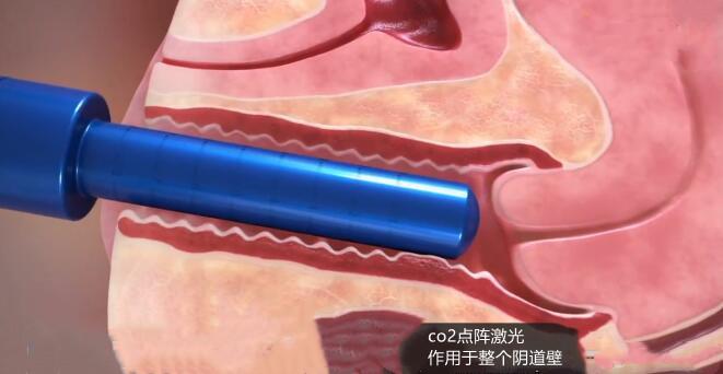 下面变黑怎么变回粉色