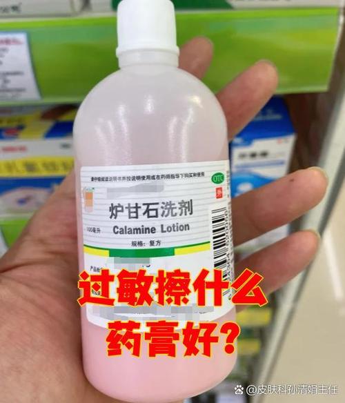 身上有红点很痒擦什么药最好
