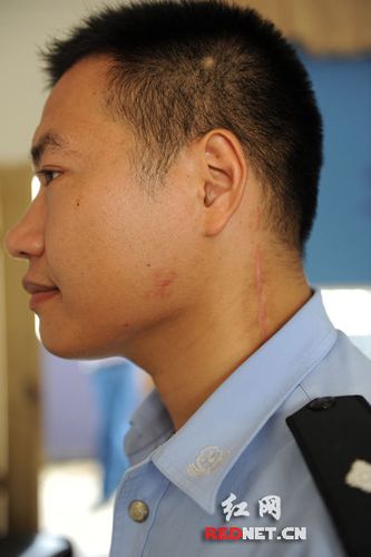 警察体检皮肤被刷