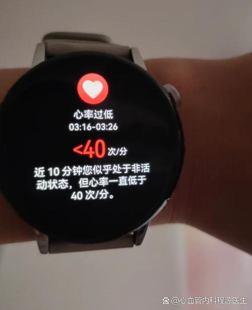 夜间心率低于40有什么危险