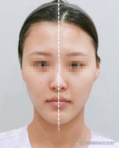 苹果手机拍照左右脸是反的解决方法