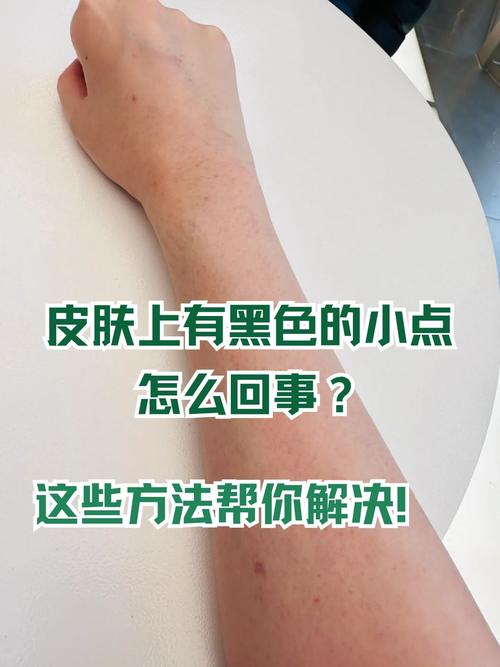 消隐点