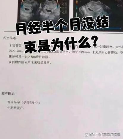 45岁月经来了半个月不走怎么回事缩略图