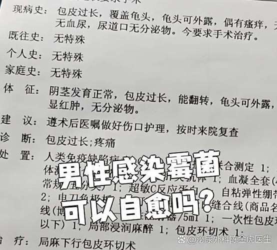 霉菌自愈的最佳方法