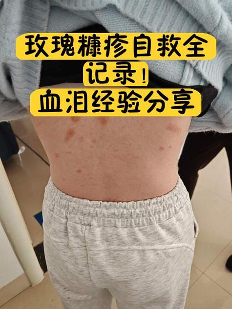 苄在药名中什么读音