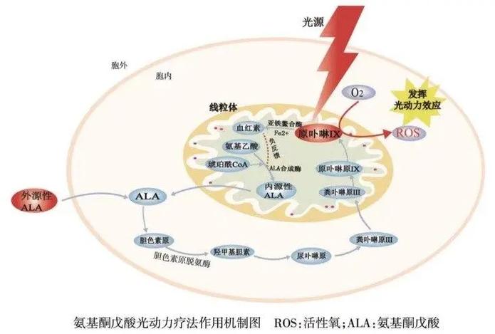 pdt治疗缩略图