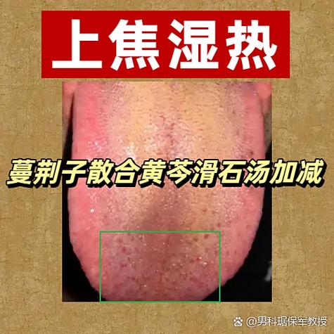 耳朵丝丝响是什么原因
