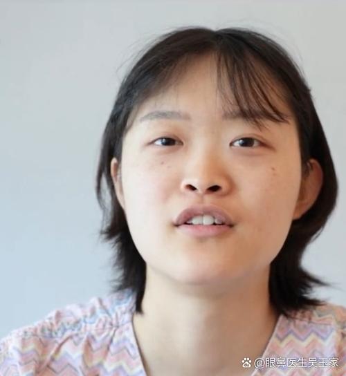 苹果手机照片怎么把人去掉