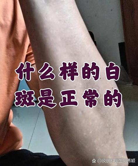 电脑白斑正常吗图标