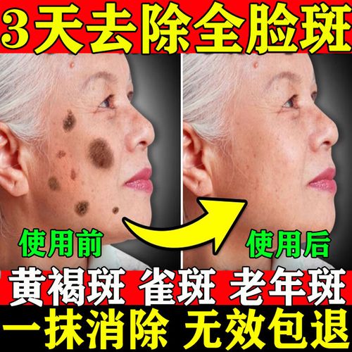 肤研生产日期一擦就掉怎么处理