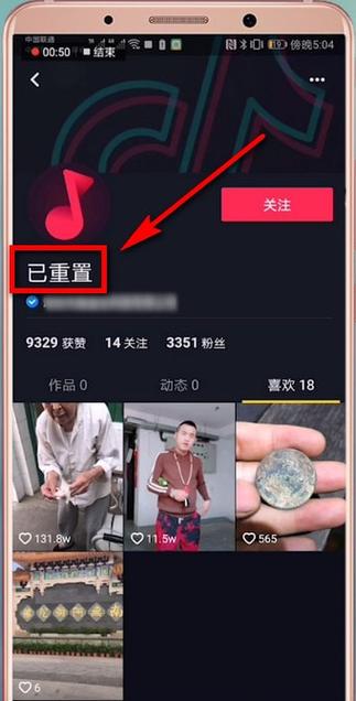 怎么把抖音快速重置