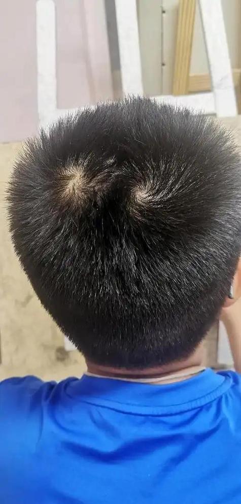 男孩额头有旋图片