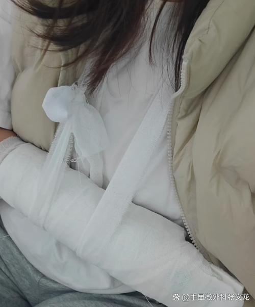 胳膊摔了一下怎么确定有没有骨折