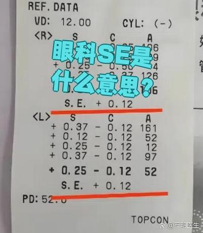 se代表啥