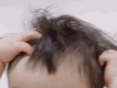 挠头gif表情包缩略图