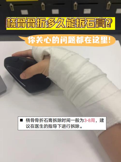 石膏怎么打