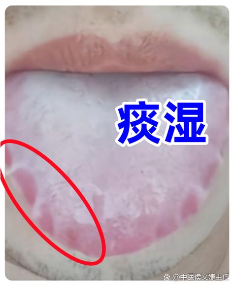 舌头舔遍了6次大便还是拉稀