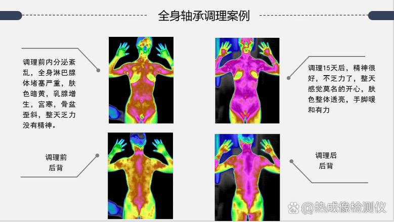 热成像仪怎么设置对比度