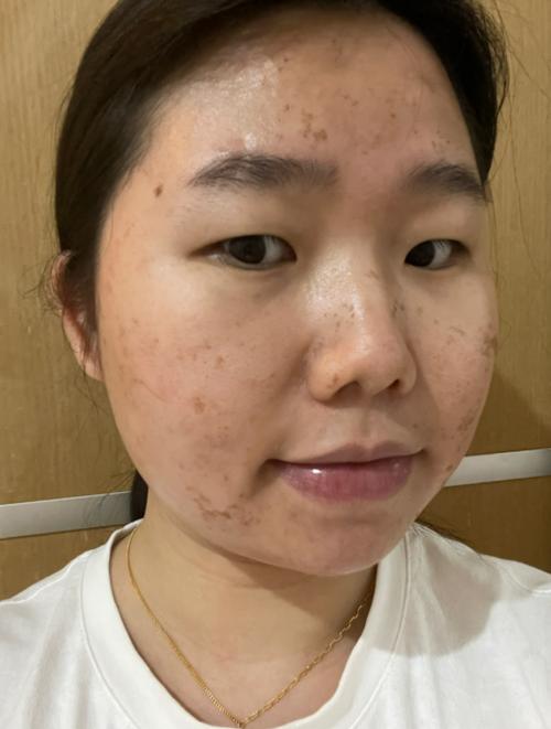 换肤封多久