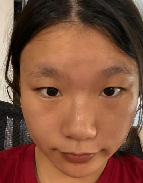 晒黑了怎么变白