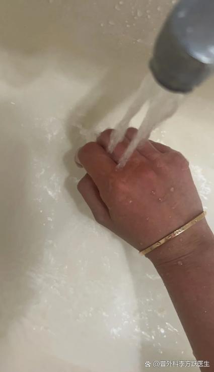 被胶水粘住缩略图
