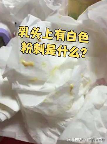 乳头挤出白色膏状物