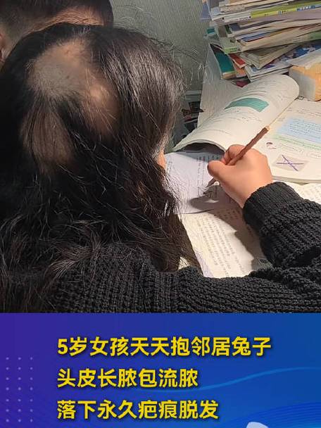 女孩摸邻居家兔子头顶长脓包