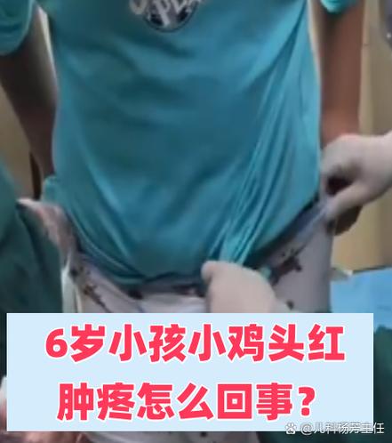 小鸡右侧疼是怎么回事