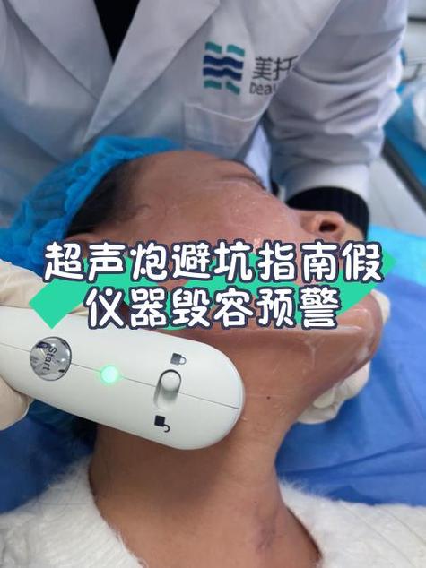 怎么消除脸上的火炮