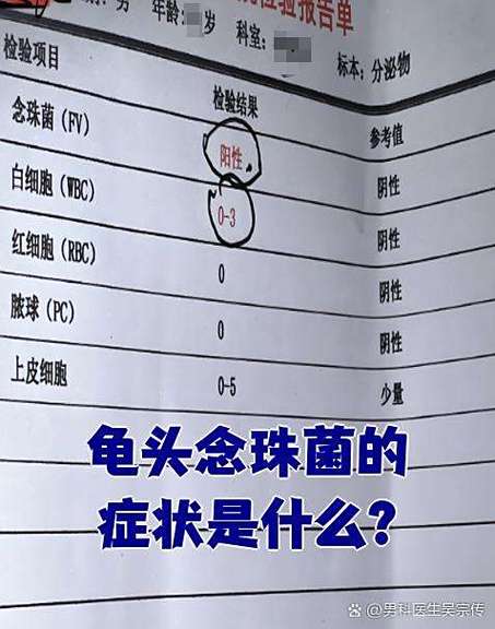 念珠菌是不是性疾病