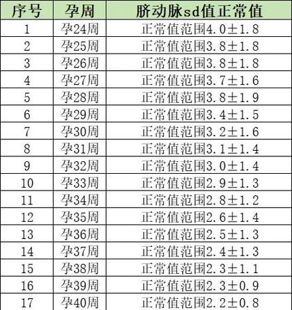 sd指什么