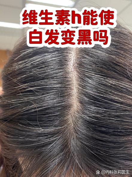 身份证白头发最简单三个步骤缩略图