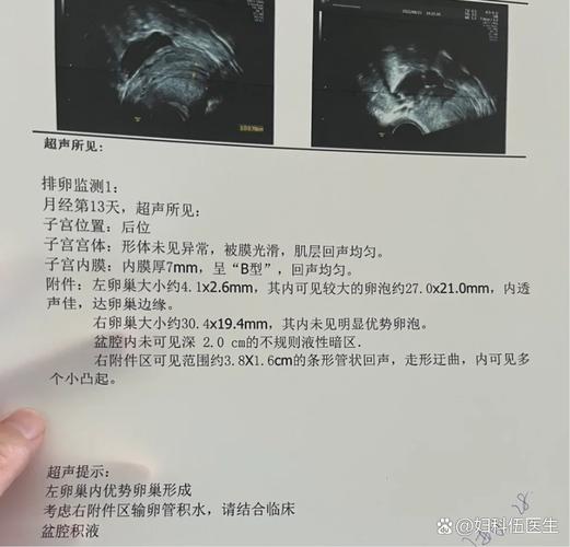 输卵管积液会癌变吗