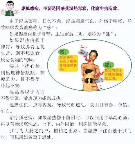 金匮要略狐惑病原文