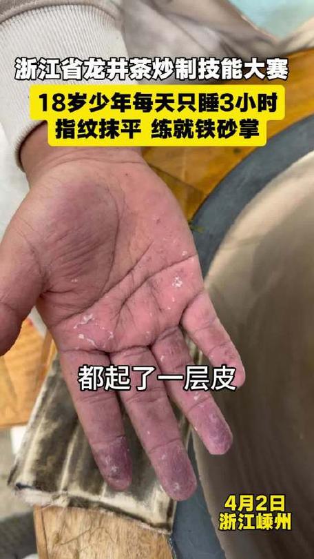 指纹磨平了多久能恢复