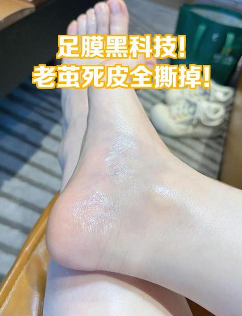 电池上的黑膜能撕吗