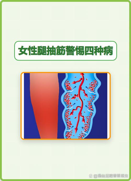 腿抽抽不舒服怎么回事截图