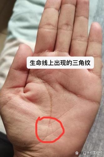 身体有大病的生命线