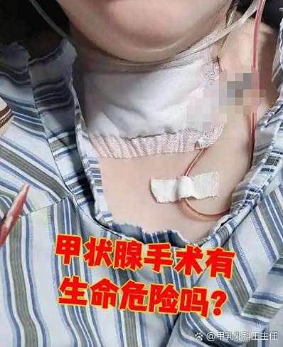 天津甲状腺肿瘤第一刀