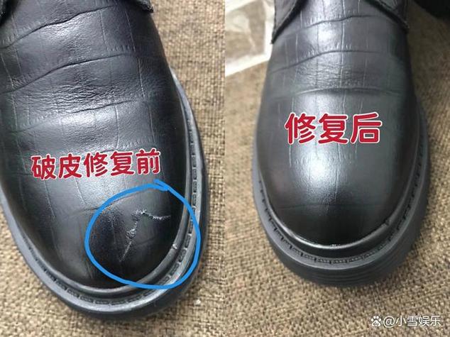 真皮破皮了怎么修补