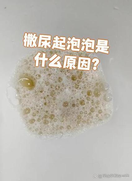 聊泡泡是什么情况