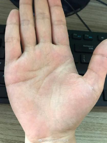 感情线中间断开又重叠接上