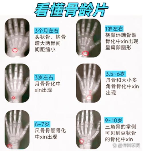 如何判断人的年龄