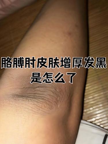 三种人坚决不能戴黑绳