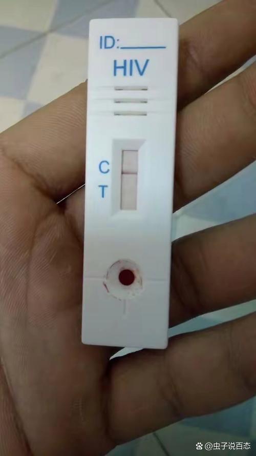 正常人hiv报告单